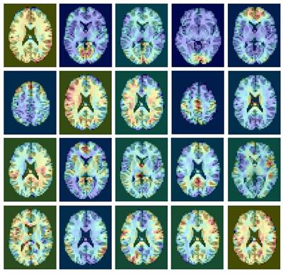 Automated Classification of Resting-State fMRI ICA Components Using a Deep Siamese Network